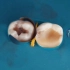 近距离观看，牙医补牙的时候，在患者嘴里缝缝补补