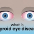 什么是甲状腺眼病（TED）？| 医学动画 | 双语字幕