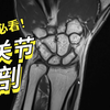 腕关节解剖不用愁，本视频帮您一次吃透