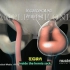 【3D医学动画】疝气（中英双字幕+原版英文）