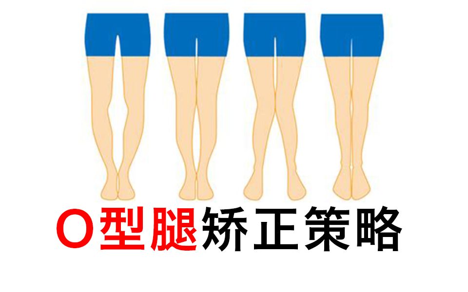 最全最专业的o型腿矫正策略 哔哩哔哩 Bilibili