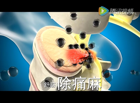 舒筋健腰丸广告30秒