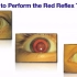 眼科检查002 红光反射检查（眼保健筛查基础）