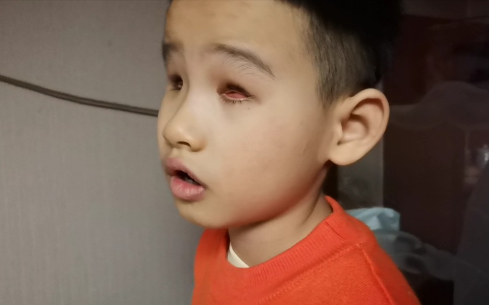 眼球 症 無