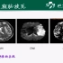 北京协和医院 冯逢-脑血管病的MRI检查要点及诊断思路