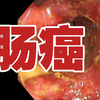 从肠癌中穿过是什么样的？肠癌长什么样子