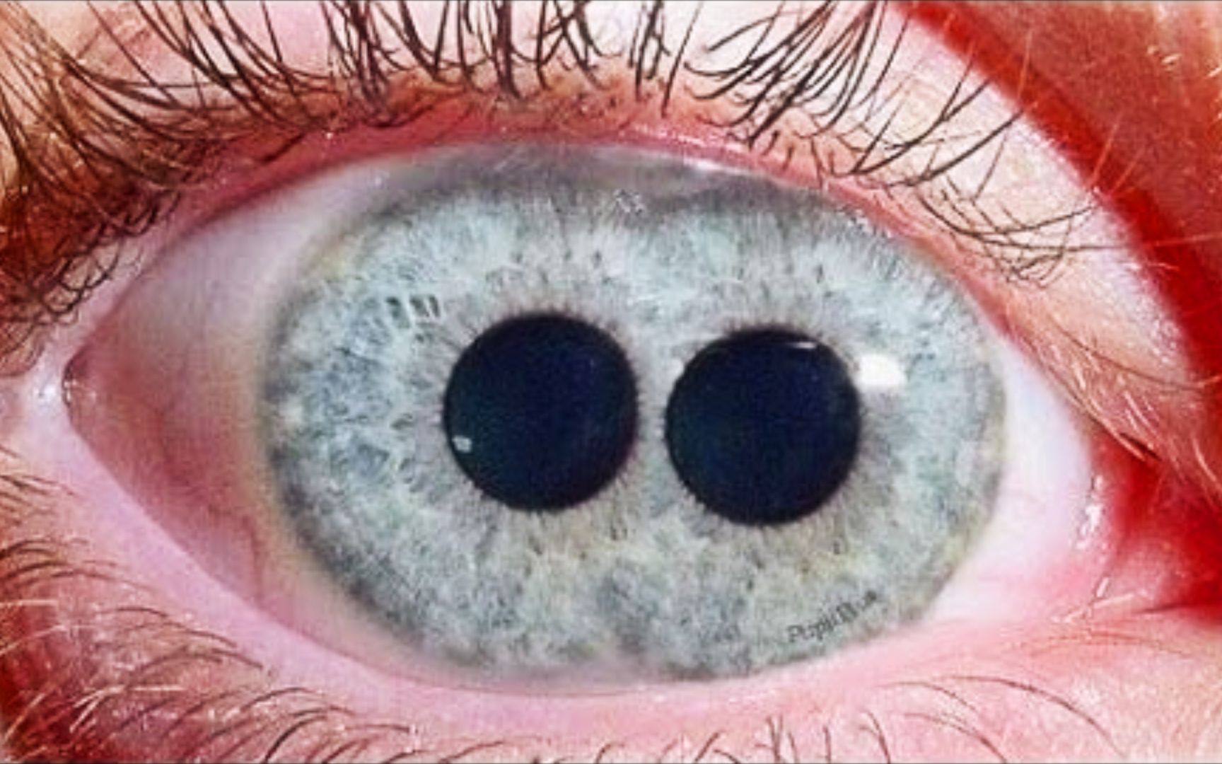 眼睛的颜色可以有多罕见？真的存在双瞳吗？世界上最罕见的眼睛