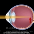 眼球近视远视成因及眼球的结构、成像原理