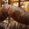 世界上最长时间不拉屎的人，三年未排便活活被屎憋死