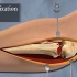 【3D医学动画】骨折修复过程