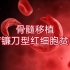 【实验疗法第一人】骨髓移植治疗镰刀型红细胞贫血症的成功案例