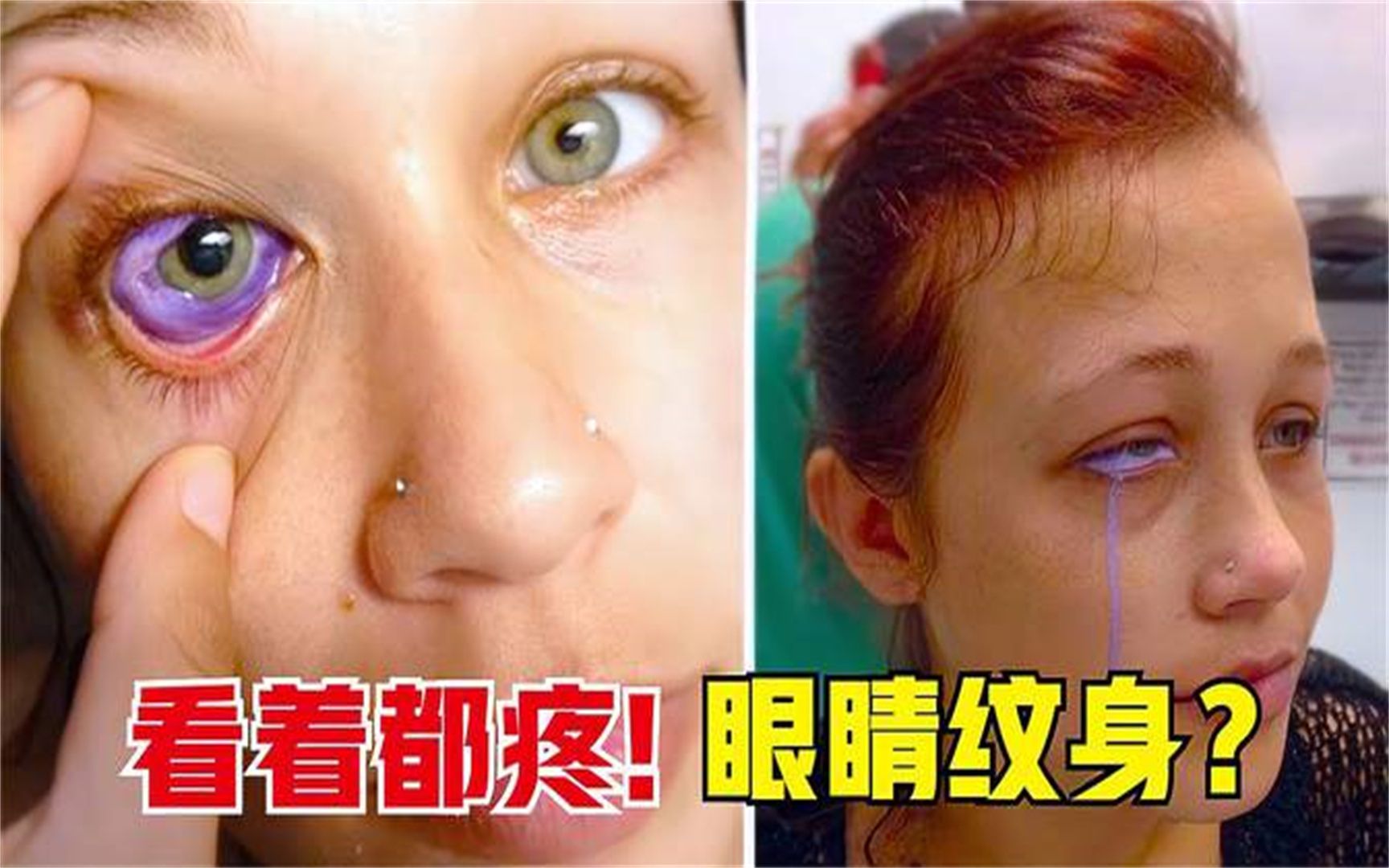 5个独特的人，女子追求紫色眼珠竟然对着眼睛纹身，看着都疼！