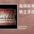 【回形针PaperClip】如何科学地矫正牙齿？