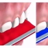 牙齿缺失以后不想做种植牙怎么办？活动假牙可以了解一下「大连齿医生口腔修复中心」「大连口腔医院」
