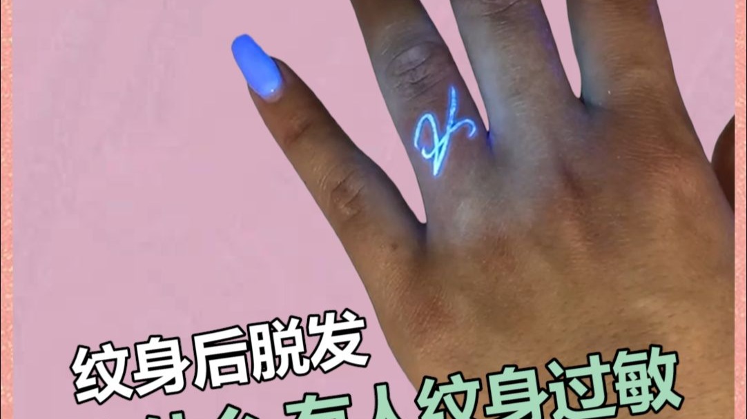 纹身过敏 为什么有人纹身后脱发