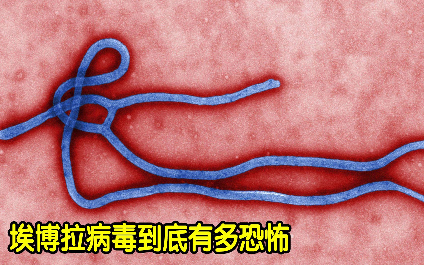 Man dies from Ebola-like Marburg virus in Uganda