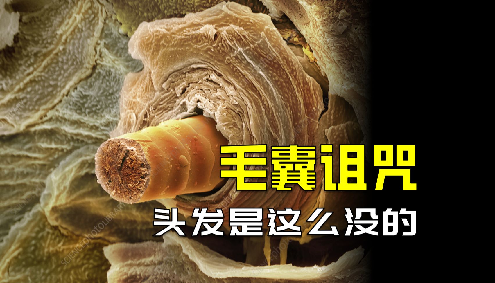 体内的激素为何是头发的敌人？