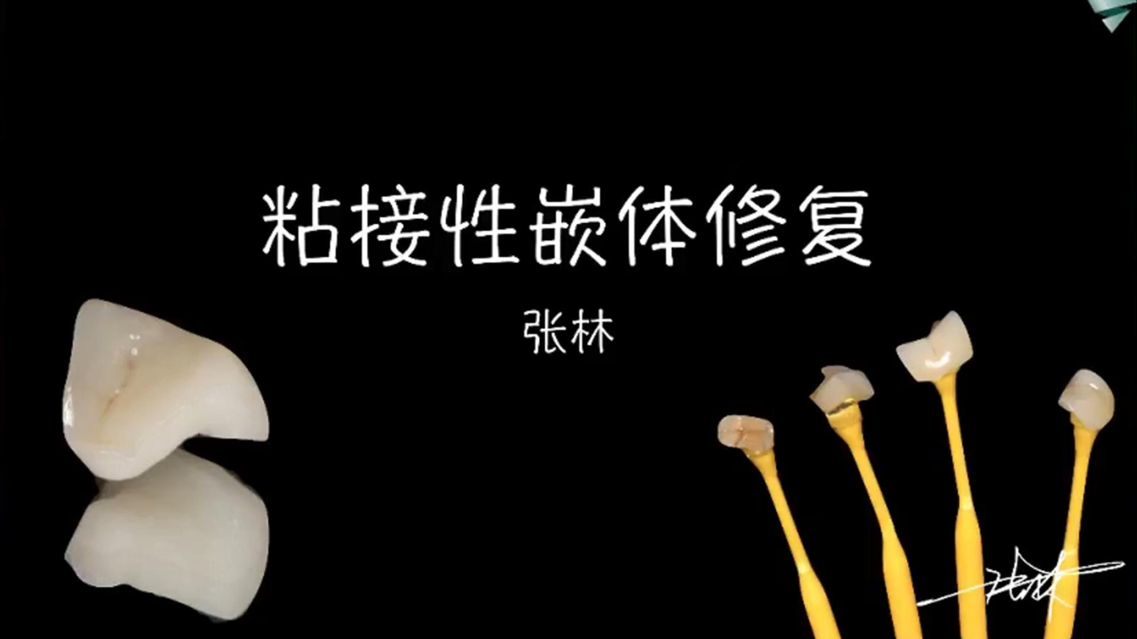 【张林】5天学会做嵌体1——影响牙体强度的因素