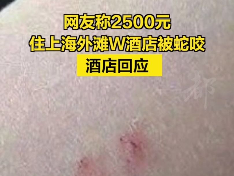 网友称2500元住上海外滩W酒店被蛇咬,酒店回应哔哩哔哩bilibili