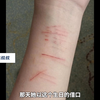 临夏12岁女孩被强奸案家属发声