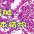 【小崔病理】30，肾脏正常结构（肾小球和肾小管）