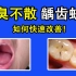 【漱口水】口臭不散？龋齿蛀牙？如何日常改善的方法，来喽！