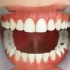 【树脂补牙】了解补牙全过程