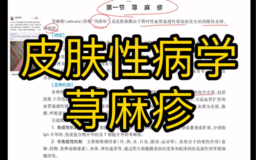 荨麻疹【皮肤性病学期末速成8】