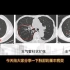 肺部基本影像科普：支气管及支气管扩张在CT上的典型征象！