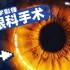 高速相机揭秘近视手术，医生在眼球上到底做了啥？