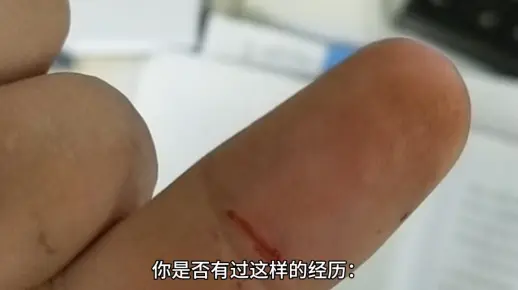 "探索纸张杀伤力：刀割VS纸割，疼痛真相揭秘"