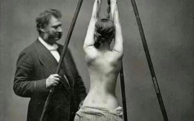 1876年 英国·在治疗脊柱侧弯的女人