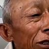 面部痉挛的症状，面肌痉挛的表现