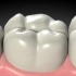 为什么要保护好牙釉质？