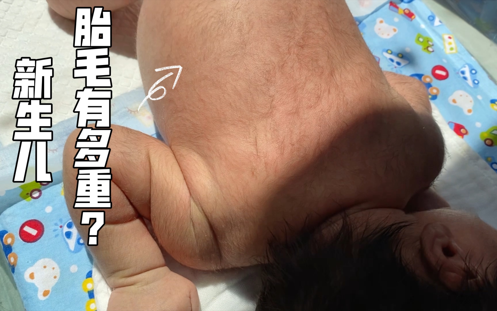 新生儿胎毛有多重？毛豆儿浓密的胎毛！