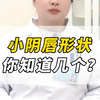 小阴唇形状 你知道几个