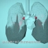 世卫组织：“生命呼吸”——空气污染如何影响您的身体