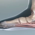 足底筋膜的重要性！