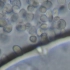显微镜下酵母发酵冒个泡