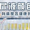尿完看一眼就能保命，这种颜色的尿液是身体大病的信号