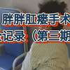 高位复杂性肛瘘加肛周脓肿三个脓腔，终于做完了手术，创面巨大，真可怜啊