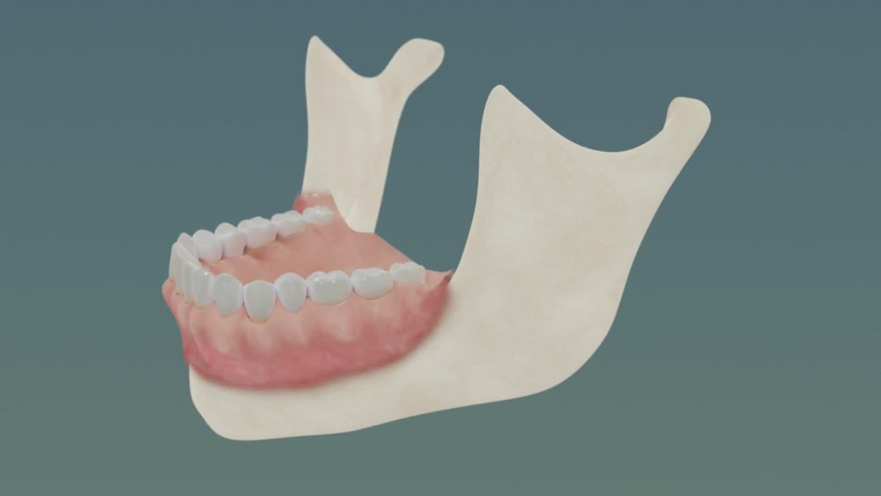 Tooth brushing, Oral Hygiene, Modifies Bass Method brushing technique