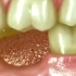 长期缺牙的地方，危害纠缠不休！不要认为掉一颗牙无所谓，长期缺牙会导致邻牙倾斜、松动、移位、龋坏[裂开]甚至牙槽骨萎缩、面