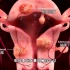 未生育和晚育都不好，介入微创栓塞动脉治疗子宫肌瘤，3D演示。。