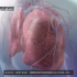 解剖和生理学｜肺水肿和急性呼吸窘迫综合征
