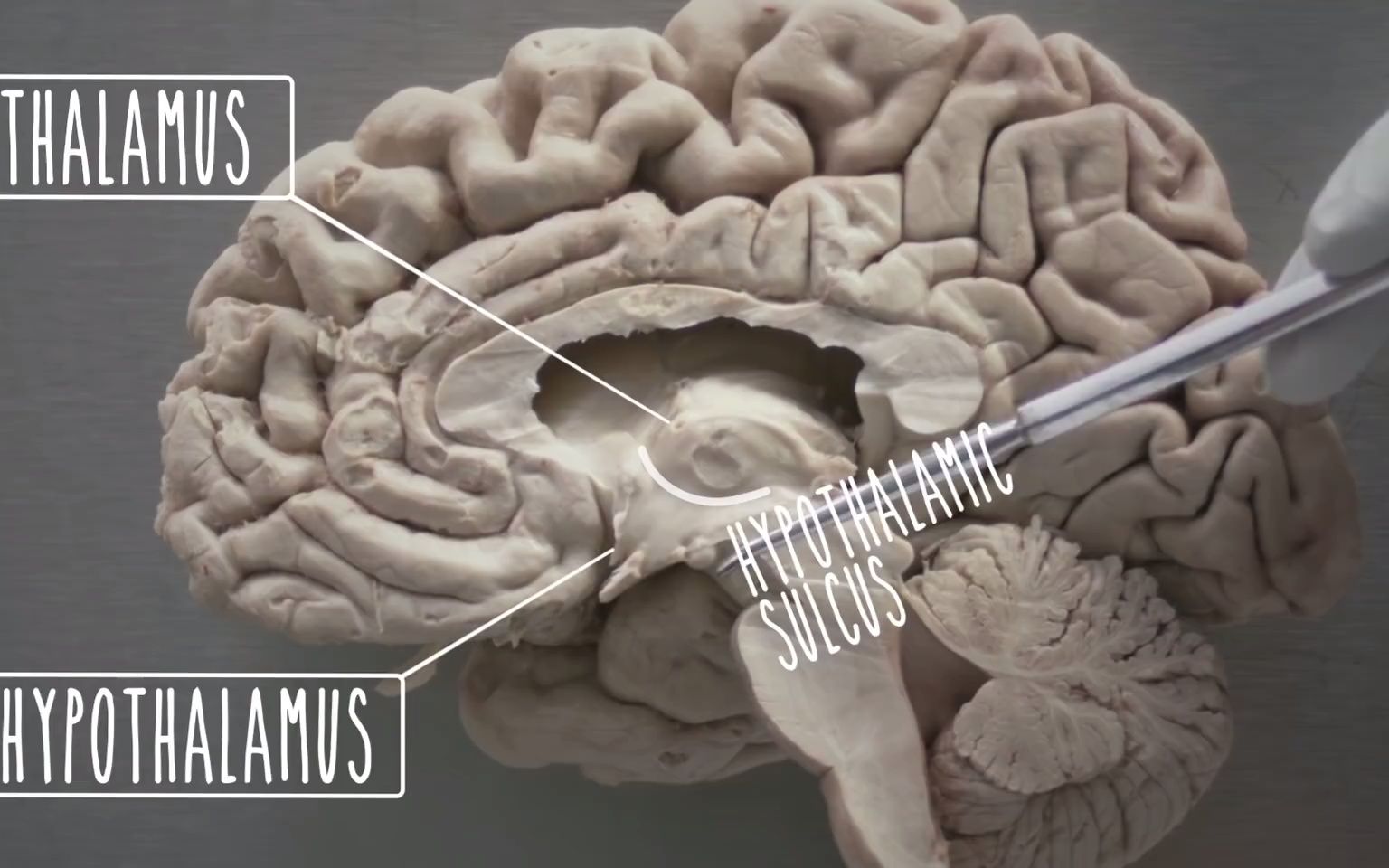 下丘脑和边缘系统的解剖 Hypothalamus and Limbic System - UBC Neuroanatomy - Season 1 - Ep 4