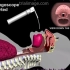 医学动画：喉部解剖与气管插管程序（英文字幕）