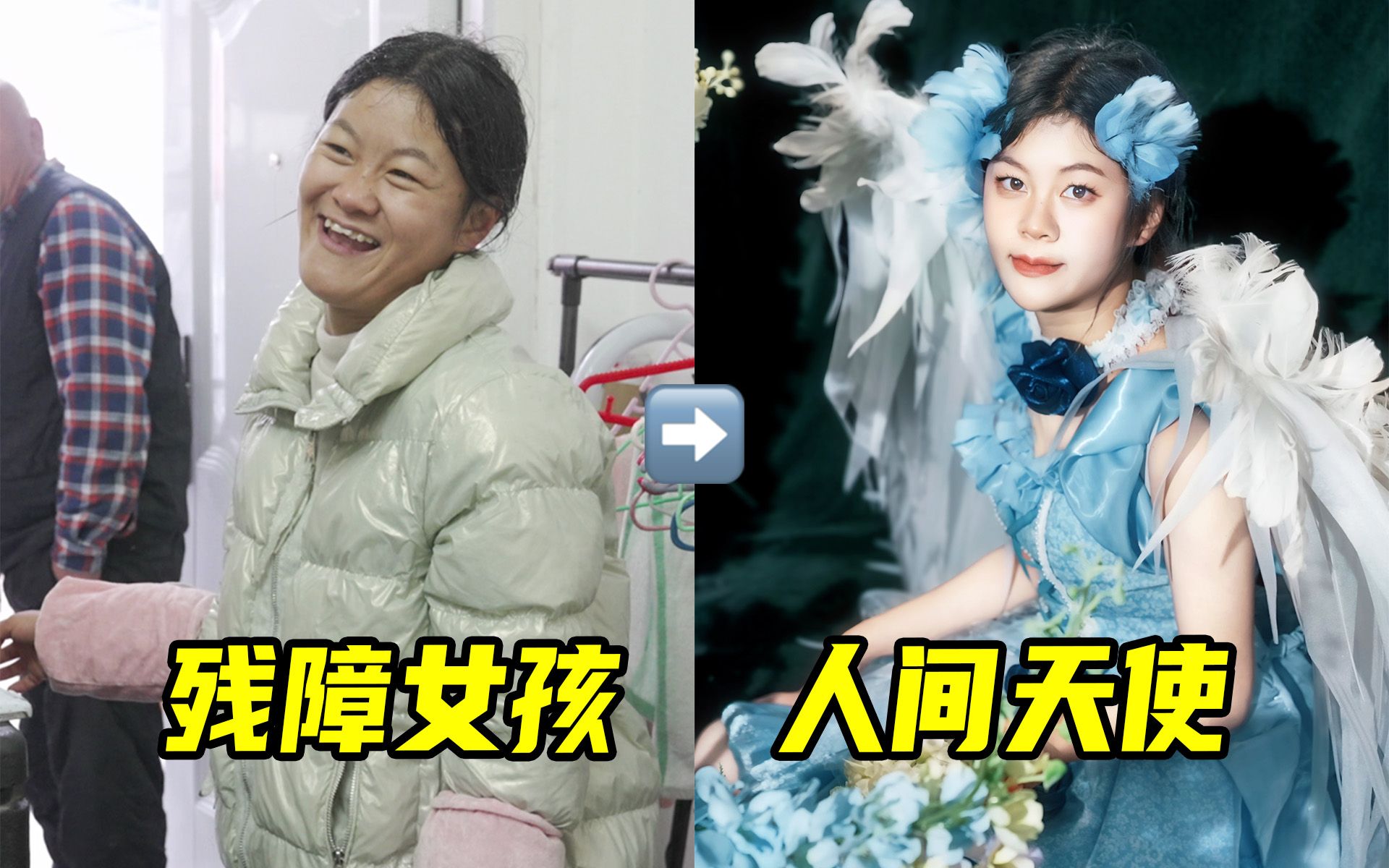 挑战用睡衣把残疾女孩爆改成天使！美到落泪