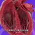 心梗为什么会胸口疼，为什么会导致致死亡，3D演示。。