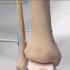 踝关节下胫腓前韧带损伤修复手术，3D。。